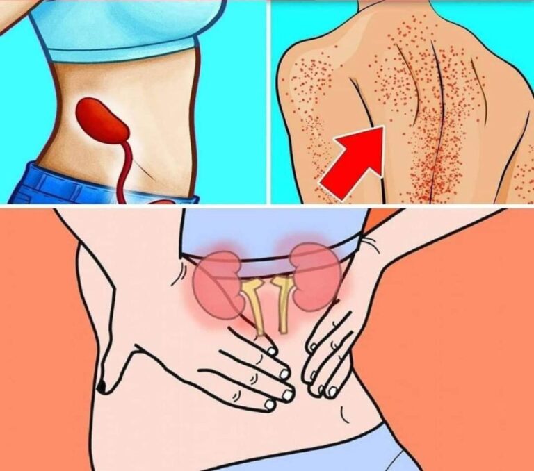 10 Warnzeichen für Nierenprobleme – Achten Sie auf diese Symptome