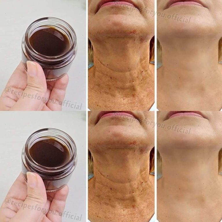 Magisches Anti-Aging-Öl: Kaffeeöl, das Falten glättet und wirksamer ist als Botox! ☕✨