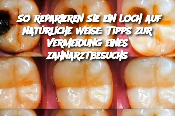 So reparieren Sie ein Loch auf natürliche Weise: Tipps zur Vermeidung eines Zahnarztbesuchs