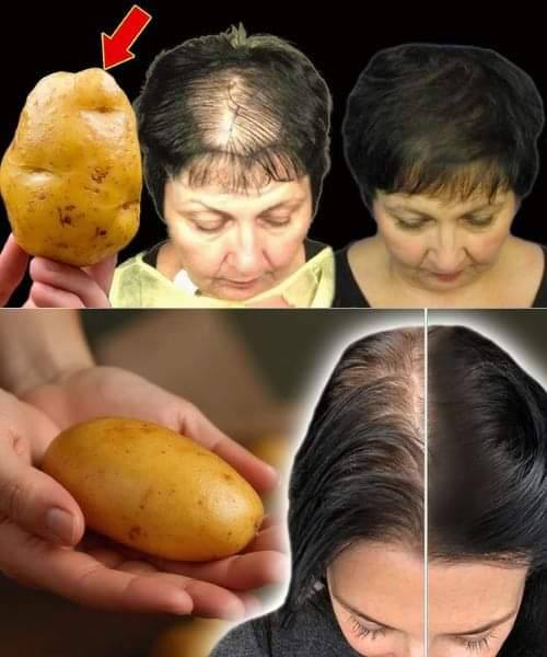 Sorgen Sie mit diesem wirkungsvollen Kartoffelrezept für schnelles Haarwachstum!