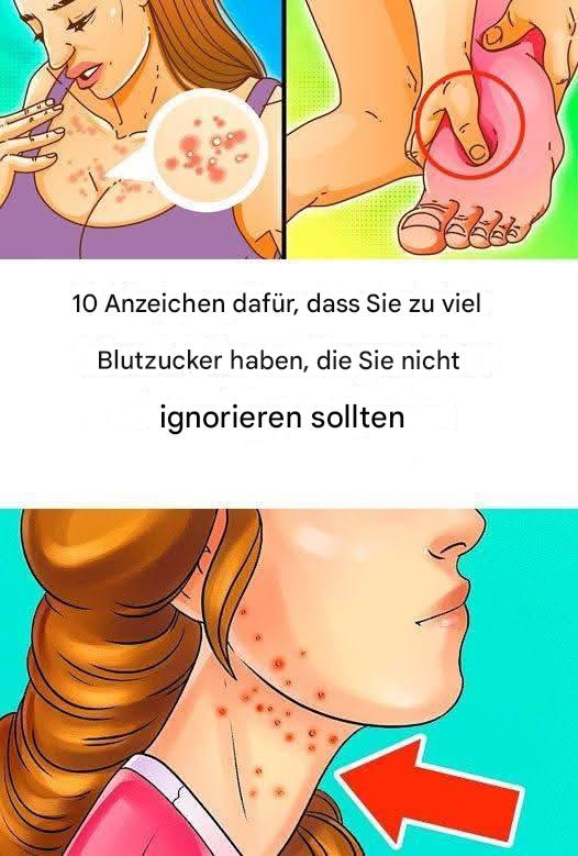 10 Anzeichen dafür, dass Sie zu viel Zucker essen